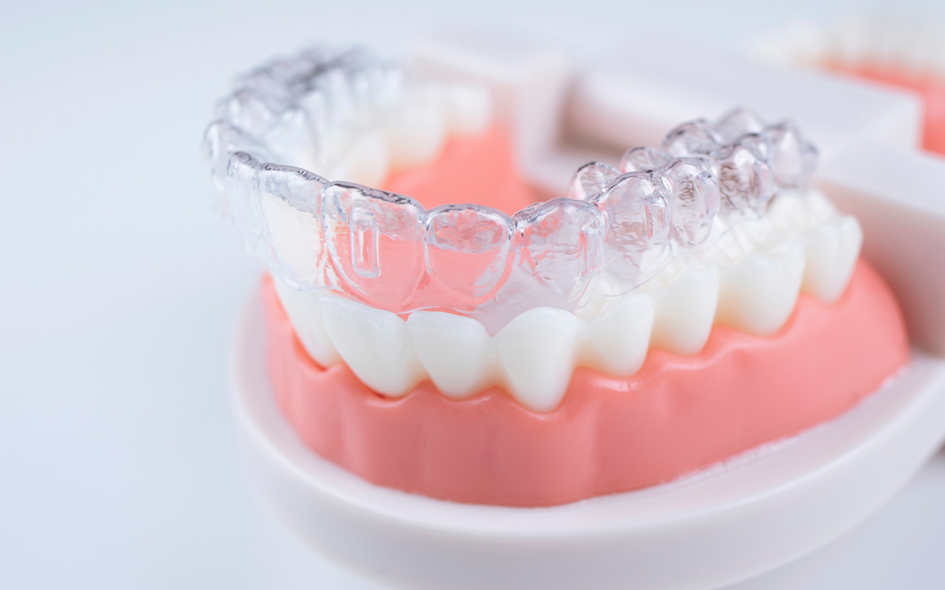 Spark Clear Aligners South Australia | Smilemore Orthodontics